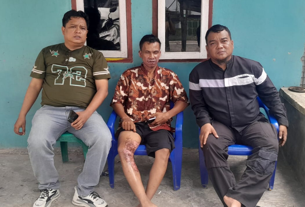Pekerja Alami Luka Bakar, FAP Tekal Pertanyakan Penerapan K3 dan Tanggung Jawab PT SDS serta PT TCI